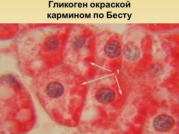 Гликоген окраской кармином по Бесту
