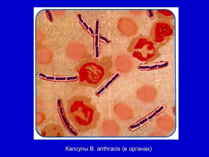 Капсулы В. anthracis (в органах)