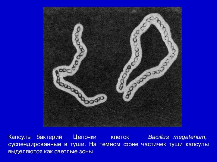 Капсулы бактерий. Цепочки клеток Bacillus megaterium, суспендированные в туши. На