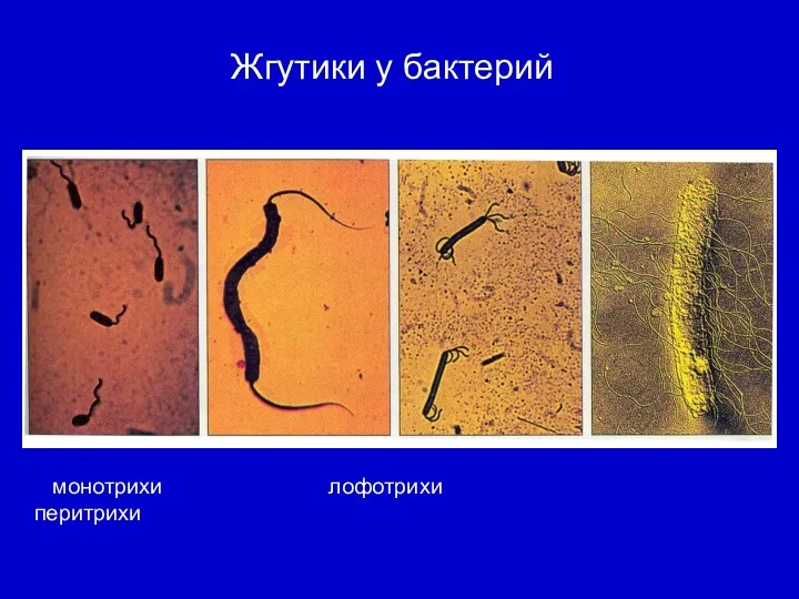 Жгутики у бактерий монотрихи лофотрихи перитрихи