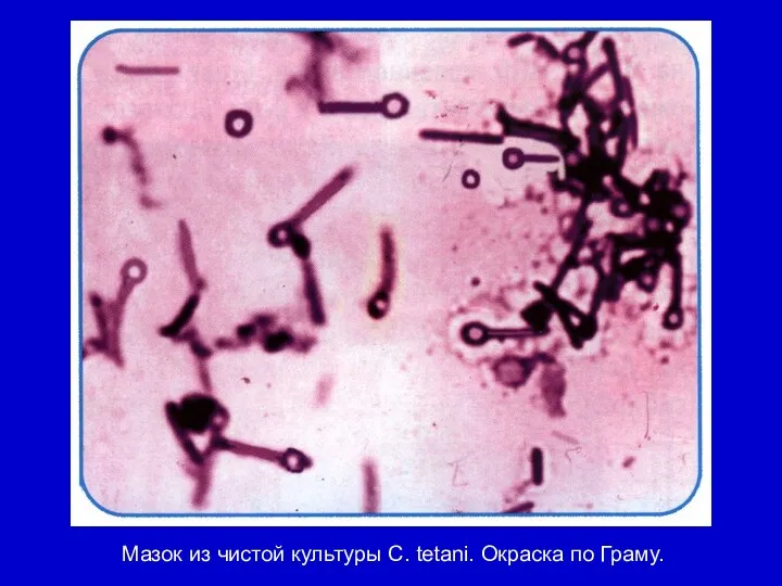 Мазок из чистой культуры С. tetani. Окраска по Граму.