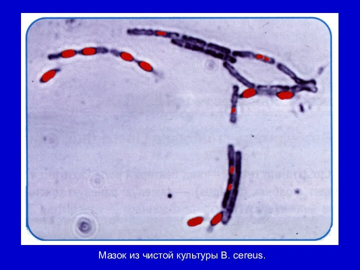 Мазок из чистой культуры В. cereus.
