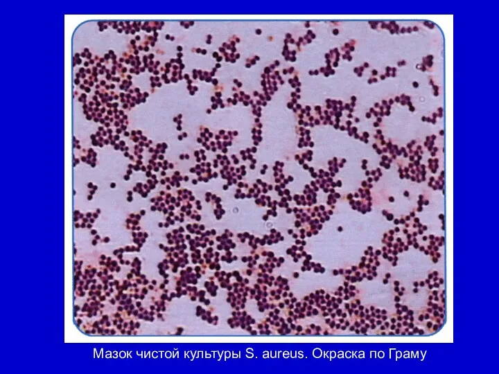 Мазок чистой культуры S. aureus. Окраска по Граму