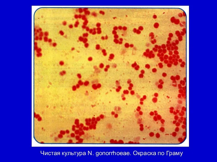 Чистая культура N. gonorrhoeae. Окраска по Граму