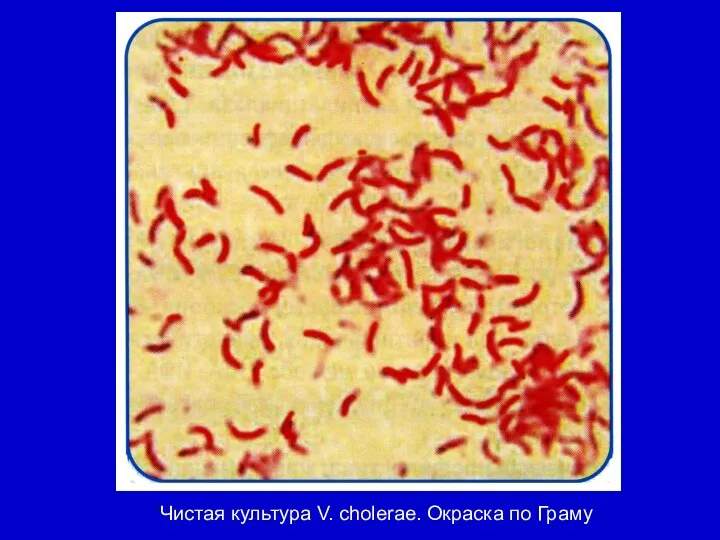 Чистая культура V. cholerae. Окраска по Граму