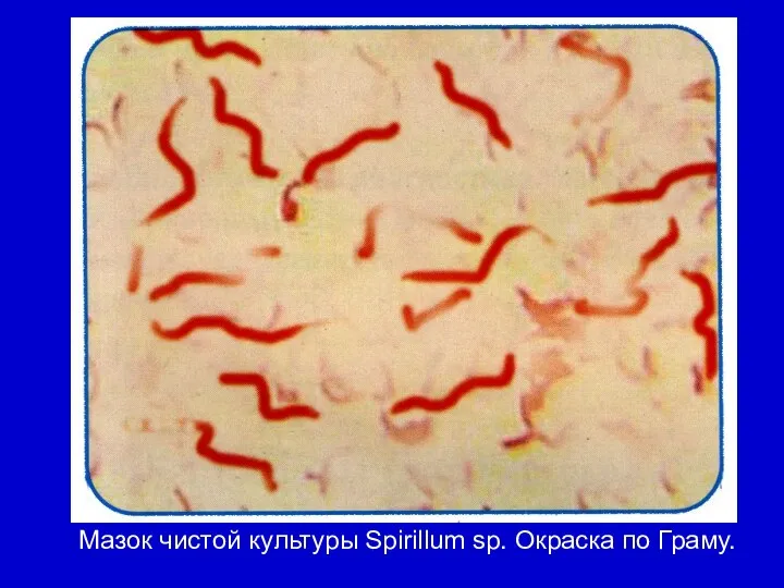 Мазок чистой культуры Spirillum sp. Окраска по Граму.