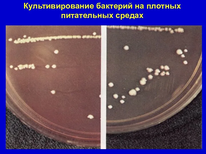 Культивирование бактерий на плотных питательных средах