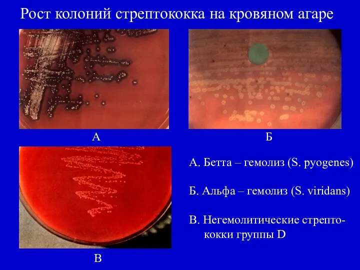 Рост колоний стрептококка на кровяном агаре А Б В А.