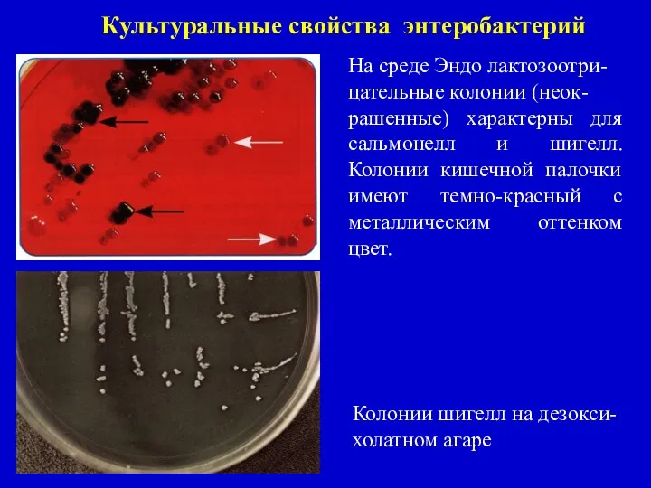 На среде Эндо лактозоотри- цательные колонии (неок- рашенные) характерны для