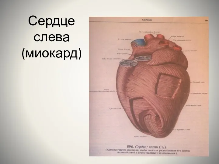 Сердце слева (миокард)