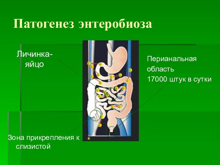 Патогенез энтеробиоза Личинка-яйцо Зона прикрепления к слизистой Перианальная область 17000 штук в сутки