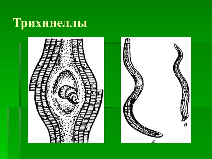 Трихинеллы