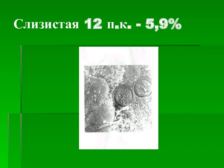 Слизистая 12 п.к. - 5,9%