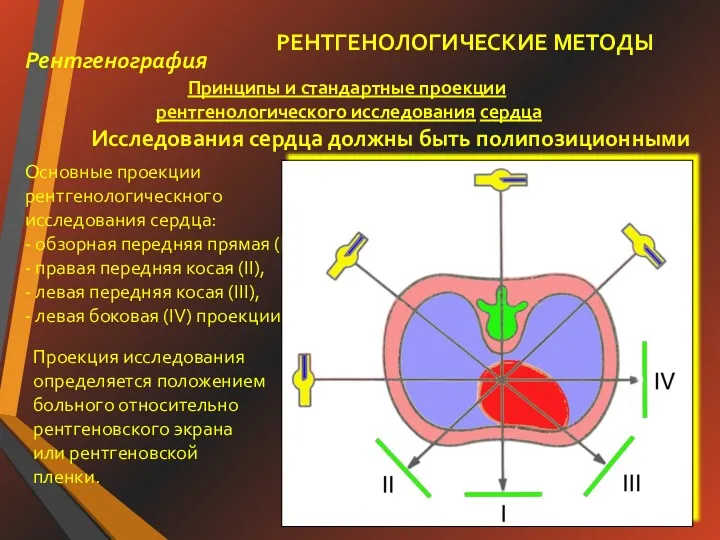 РЕНТГЕНОЛОГИЧЕСКИЕ МЕТОДЫ Принципы и стандартные проекции рентгенологического исследования сердца Исследования