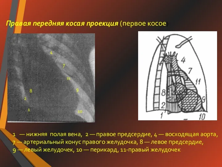 Правая передняя косая проекция (первое косое) 1 — нижняя полая