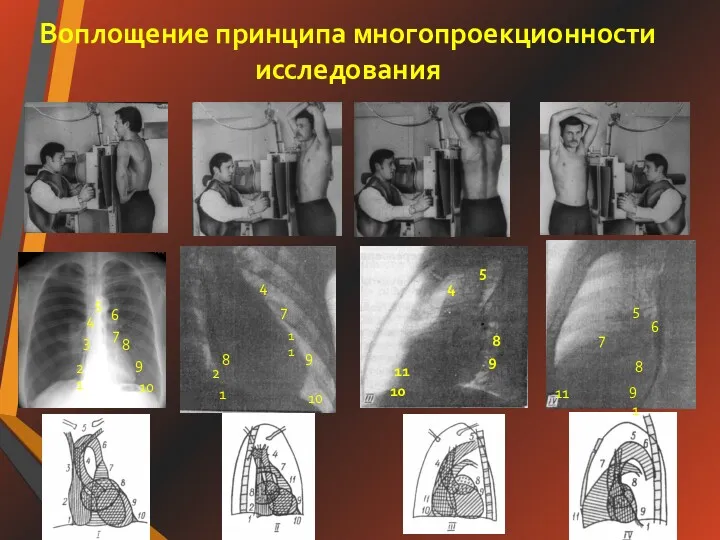 Воплощение принципа многопроекционности исследования