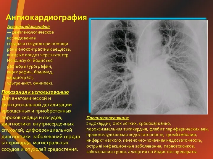 Ангиокардиография Ангиокардиография — рентгенологическое исследование сердца и сосудов при помощи