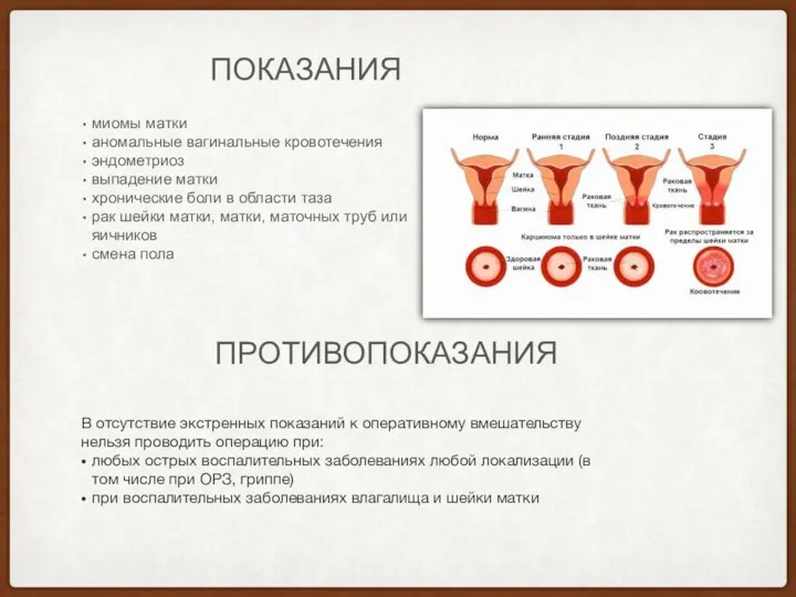 ПРОТИВОПОКАЗАНИЯ ПОКАЗАНИЯ миомы матки аномальные вагинальные кровотечения эндометриоз выпадение матки