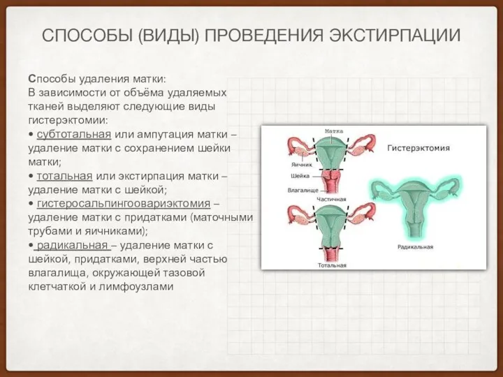 СПОСОБЫ (ВИДЫ) ПРОВЕДЕНИЯ ЭКСТИРПАЦИИ Способы удаления матки: В зависимости от