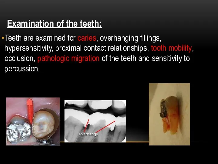Examination of the teeth: Teeth are examined for caries, overhanging