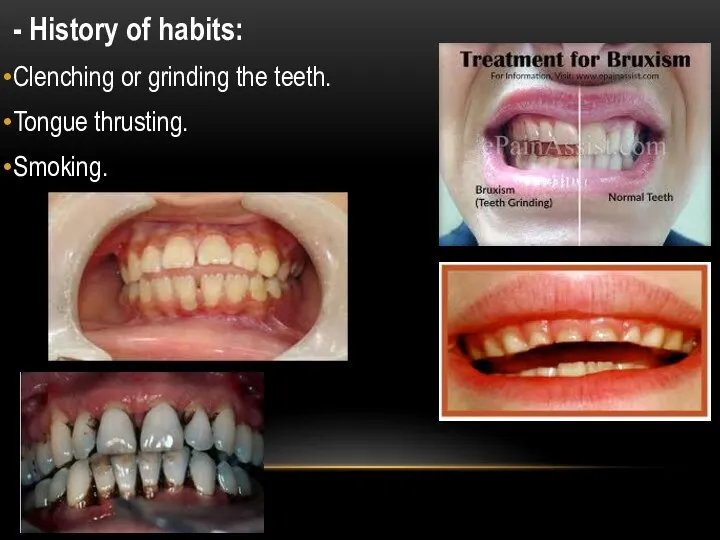 - History of habits: Clenching or grinding the teeth. Tongue thrusting. Smoking.