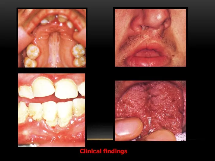 Clinical findings