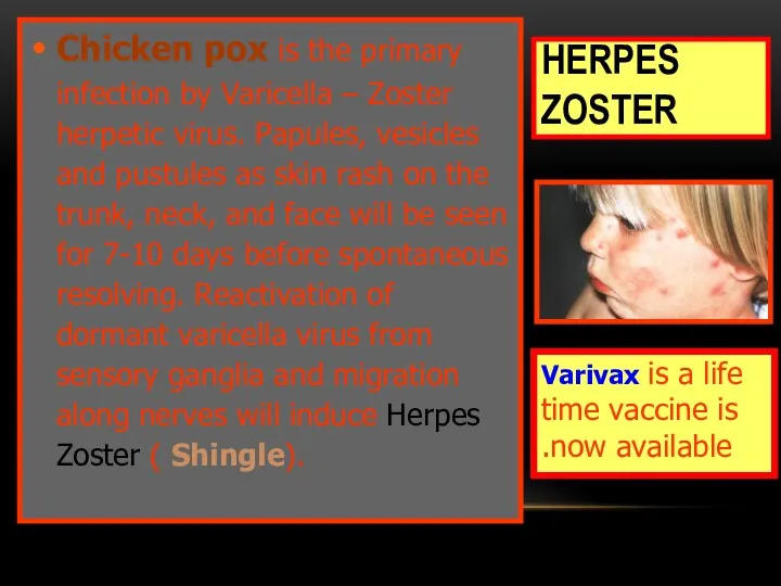 HERPES ZOSTER Chicken pox is the primary infection by Varicella