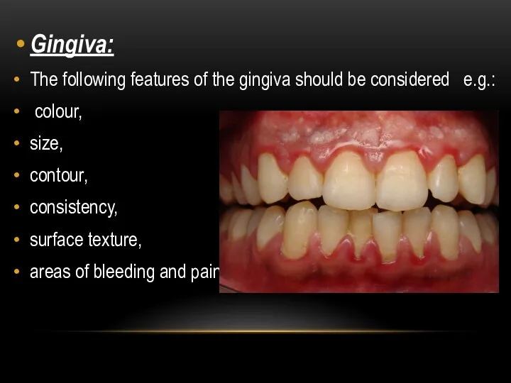 Gingiva: The following features of the gingiva should be considered