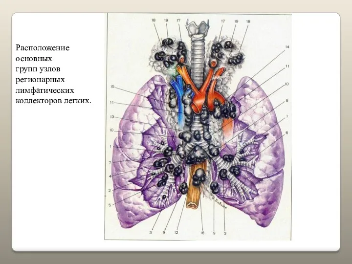 Расположение основных групп узлов регионарных лимфатических коллекторов легких.