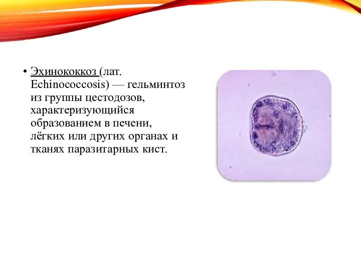 Эхинококкоз (лат. Echinococcosis) — гельминтоз из группы цестодозов, характеризующийся образованием