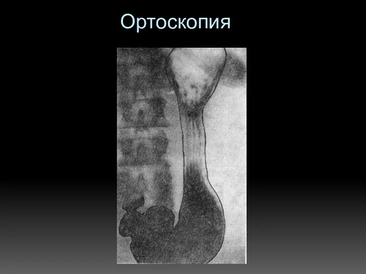 Ортоскопия