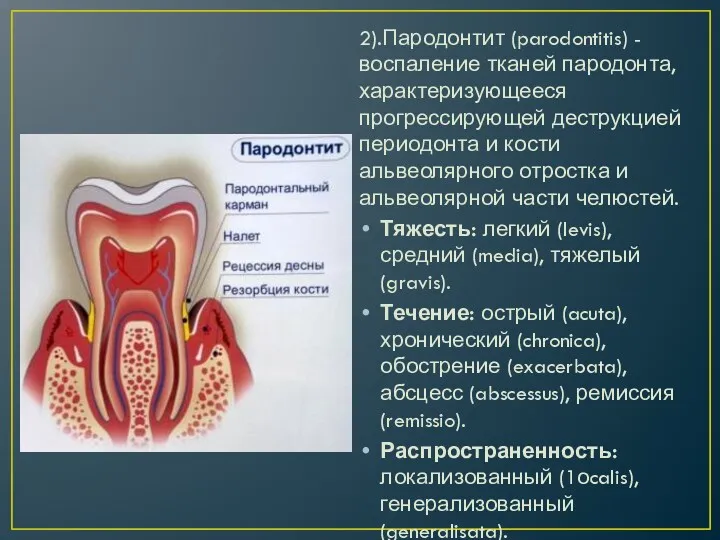 2).Пародонтит (parodontitis) - воспаление тканей пародонта, характеризующееся прогрессирующей деструкцией периодонта и кости альвеолярного