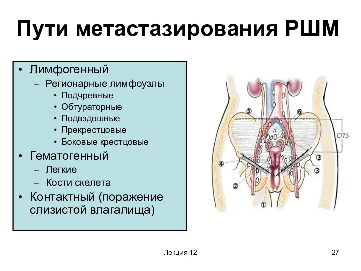 Лекция 12 Пути метастазирования РШМ Лимфогенный Регионарные лимфоузлы Подчревные Обтураторные