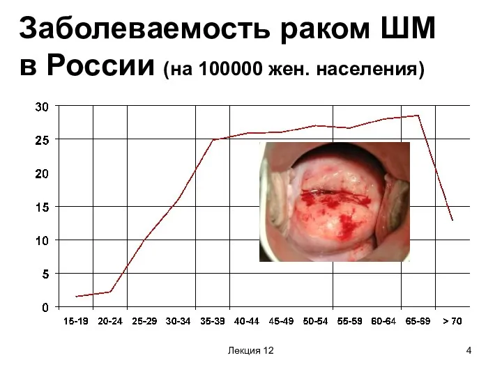 Лекция 12 Заболеваемость раком ШМ в России (на 100000 жен. населения)