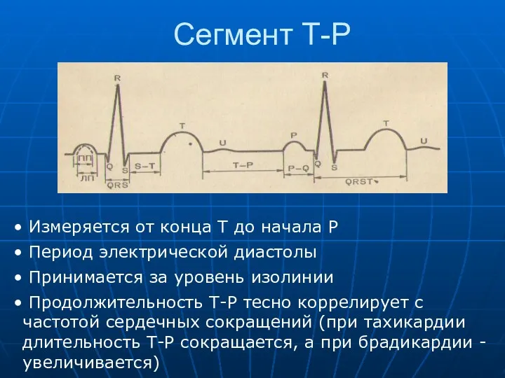 Сегмент Т-Р Измеряется от конца Т до начала Р Период