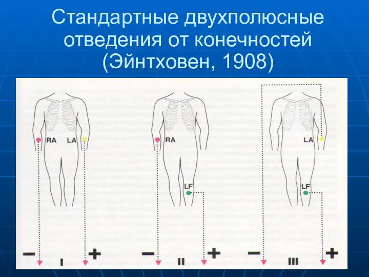 Стандартные двухполюсные отведения от конечностей (Эйнтховен, 1908)