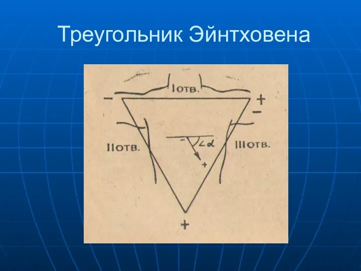 Треугольник Эйнтховена