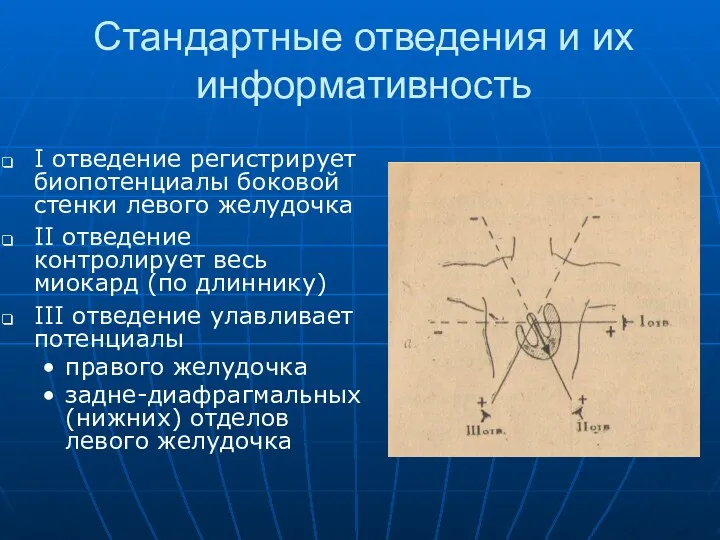 Стандартные отведения и их информативность I отведение регистрирует биопотенциалы боковой