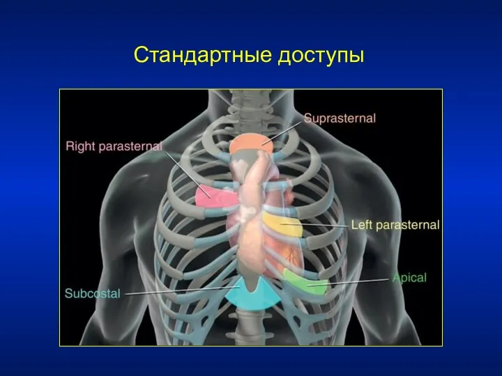 Стандартные доступы