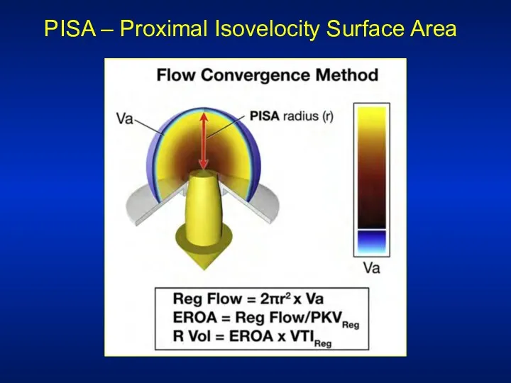 PISA – Proximal Isovelocity Surface Area
