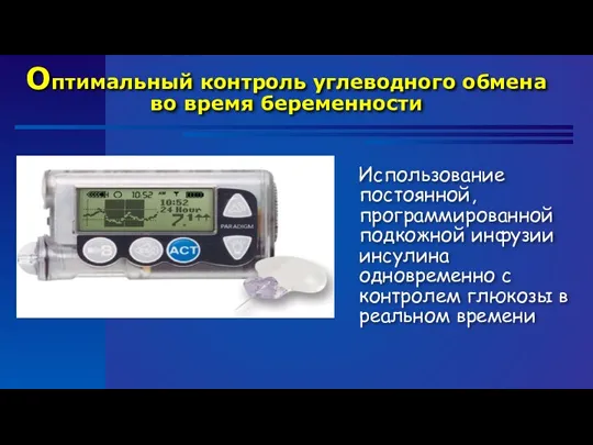 Оптимальный контроль углеводного обмена во время беременности Использование постоянной, программированной