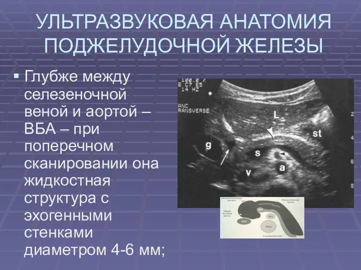 УЛЬТРАЗВУКОВАЯ АНАТОМИЯ ПОДЖЕЛУДОЧНОЙ ЖЕЛЕЗЫ Глубже между селезеночной веной и аортой