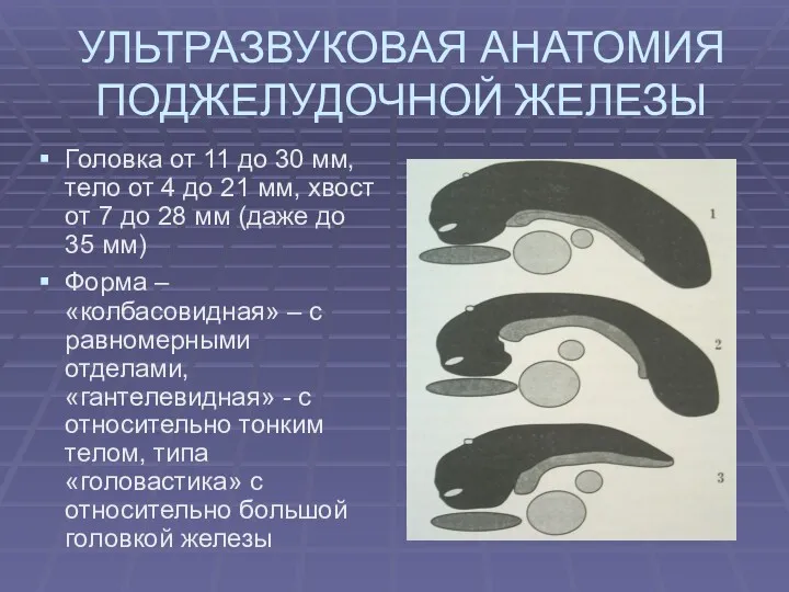 УЛЬТРАЗВУКОВАЯ АНАТОМИЯ ПОДЖЕЛУДОЧНОЙ ЖЕЛЕЗЫ Головка от 11 до 30 мм,