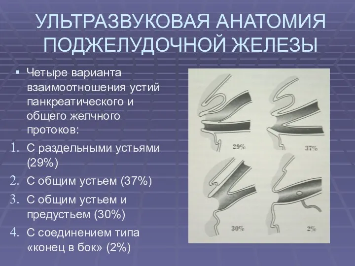 УЛЬТРАЗВУКОВАЯ АНАТОМИЯ ПОДЖЕЛУДОЧНОЙ ЖЕЛЕЗЫ Четыре варианта взаимоотношения устий панкреатического и