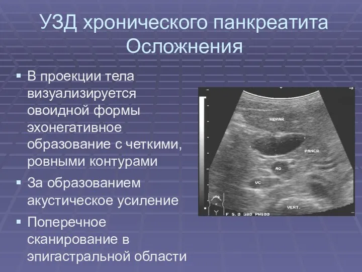 УЗД хронического панкреатита Осложнения В проекции тела визуализируется овоидной формы