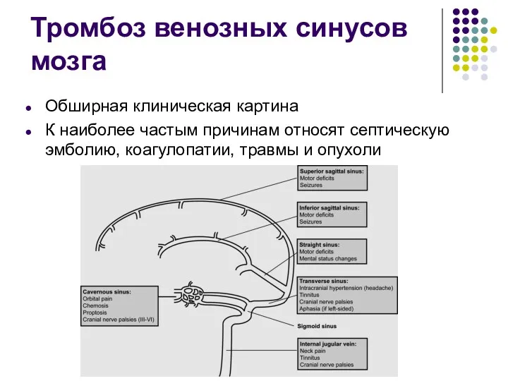 Тромбоз венозных синусов мозга Обширная клиническая картина К наиболее частым