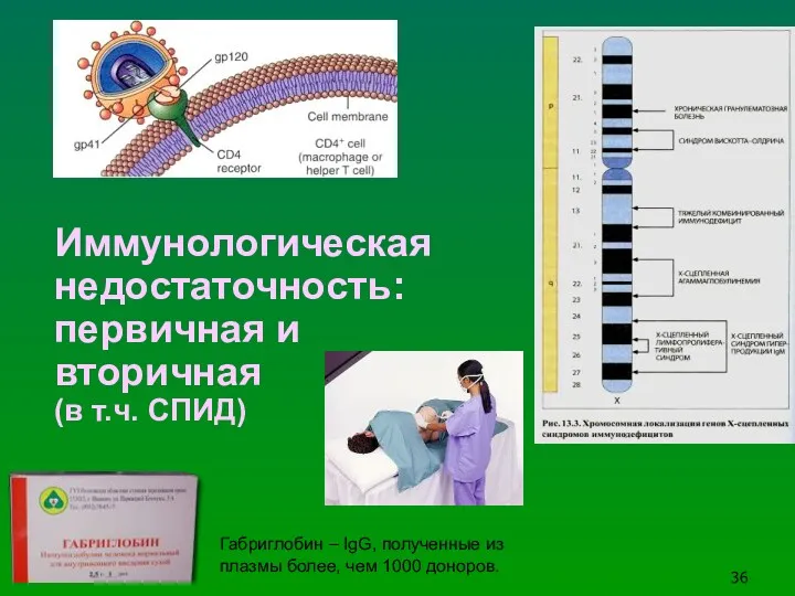 Иммунологическая недостаточность: первичная и вторичная (в т.ч. СПИД) Габриглобин –