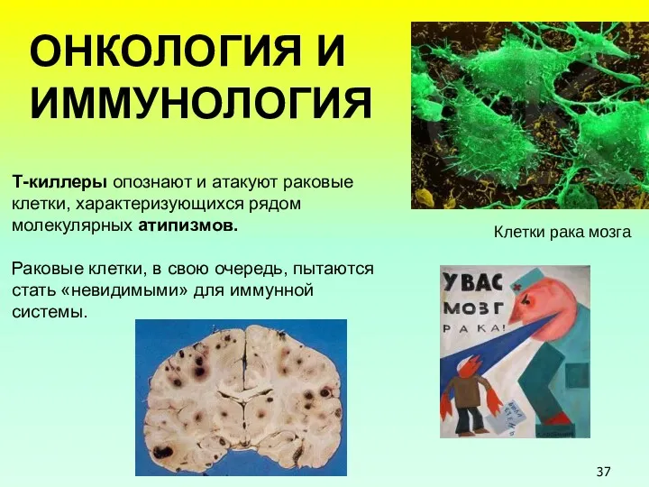 ОНКОЛОГИЯ И ИММУНОЛОГИЯ Т-киллеры опознают и атакуют раковые клетки, характеризующихся рядом молекулярных атипизмов.