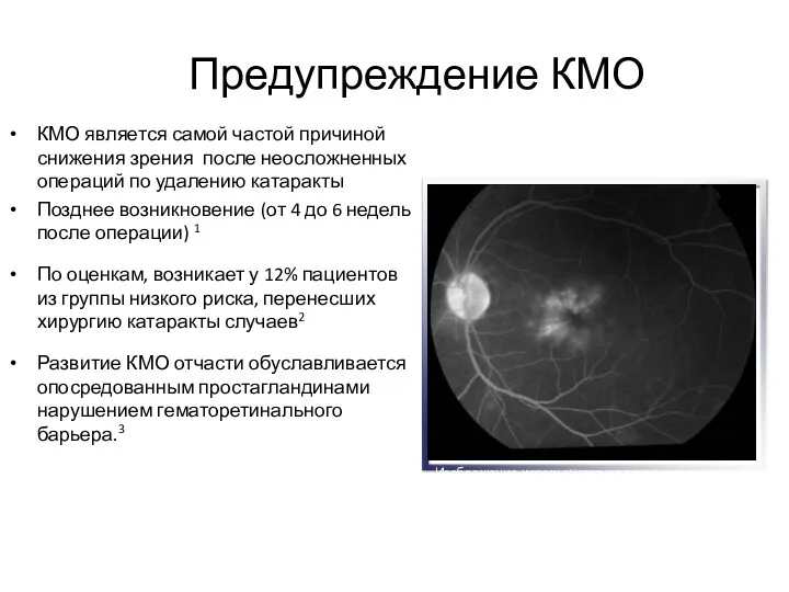 Предупреждение КМО КМО является самой частой причиной снижения зрения после