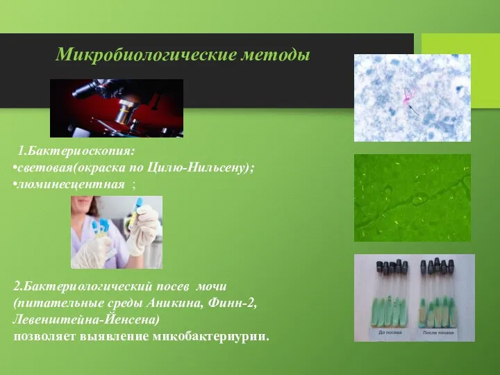 Микробиологические методы 1.Бактериоскопия: световая(окраска по Цилю-Нильсену); люминесцентная ; 2.Бактериологический посев
